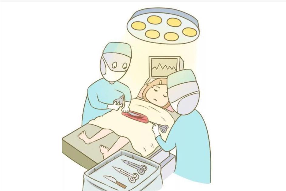 剖腹产后多长时间可以同房？过早*生活性**有什么风险？进来告诉你