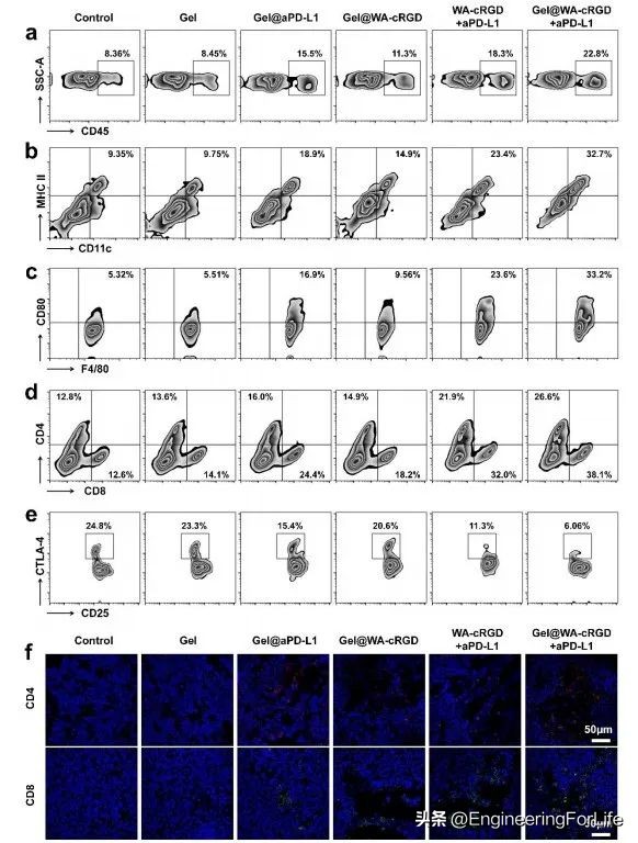 可注射水凝胶协同铁死亡免疫疗法用于肿瘤术后管理
