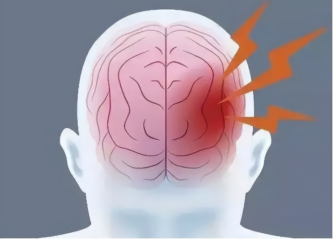 脑梗塞引起的焦虑症怎么办,脑梗塞发作时最迫切的急救方法是