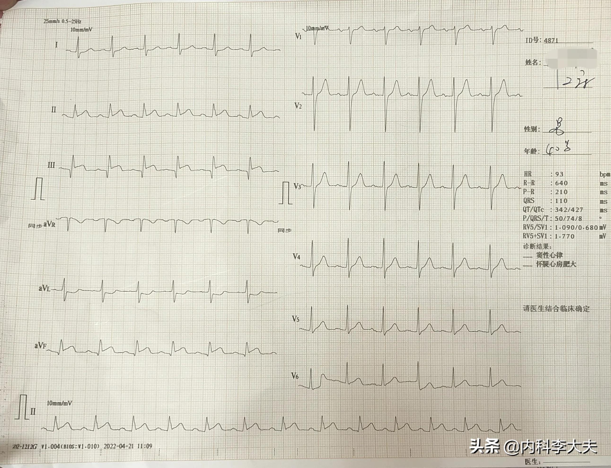 年纪轻轻有什么可怕的,年纪轻轻得了多发腔梗怎么办