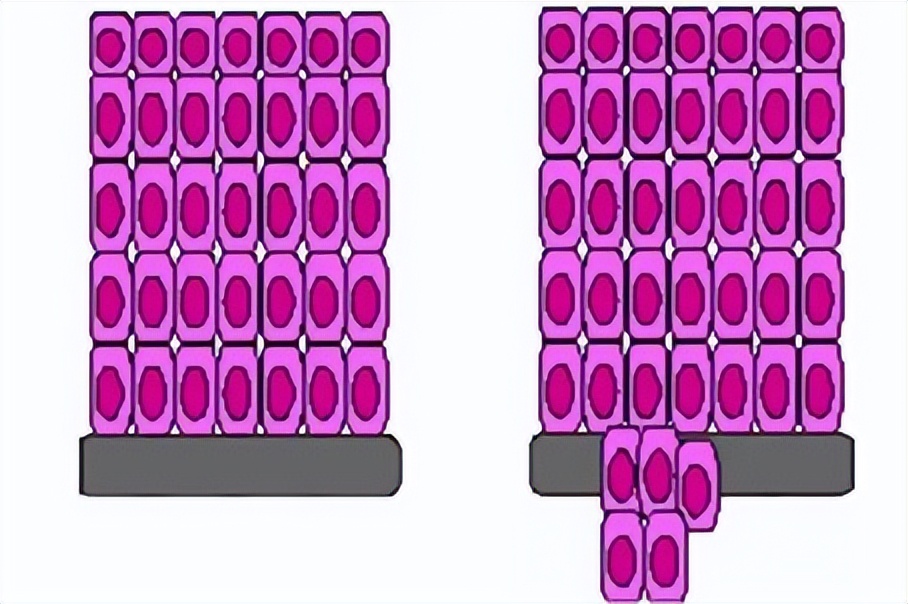 派特生物能治宫颈湿疣吗,派特灵妇科