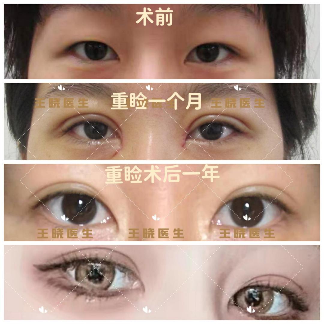 夏天美容整形,医院美容护肤项目