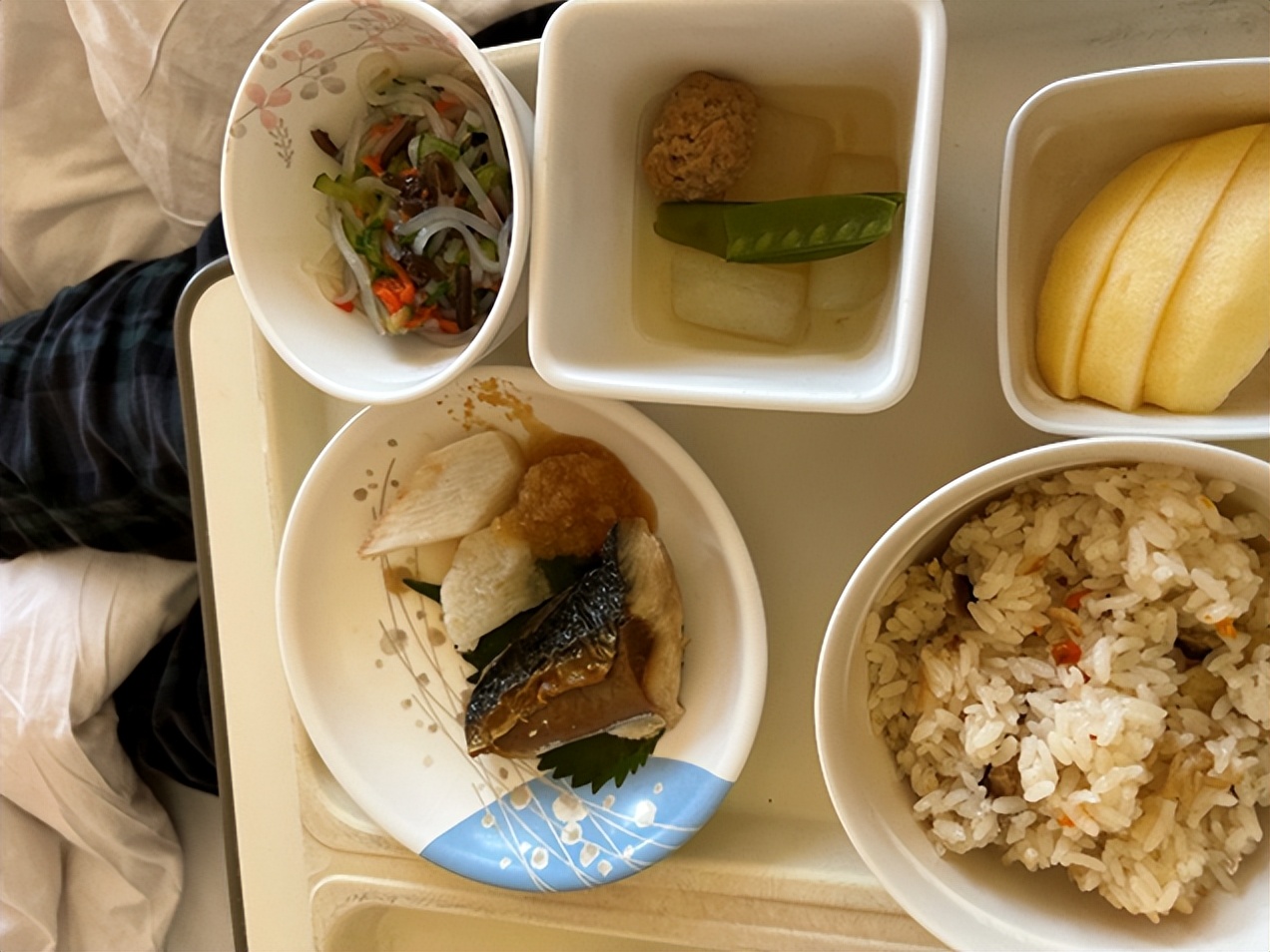 割完痔疮肛门一收缩就疼,割了痔疮为啥腰疼