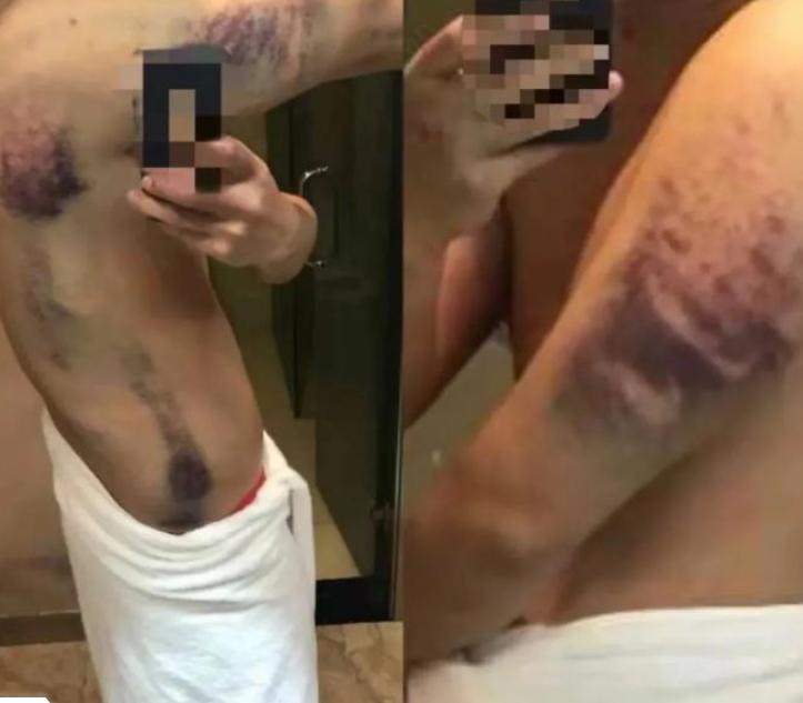 缅北被骗女性赌博,缅北地区赌博诈骗窝点