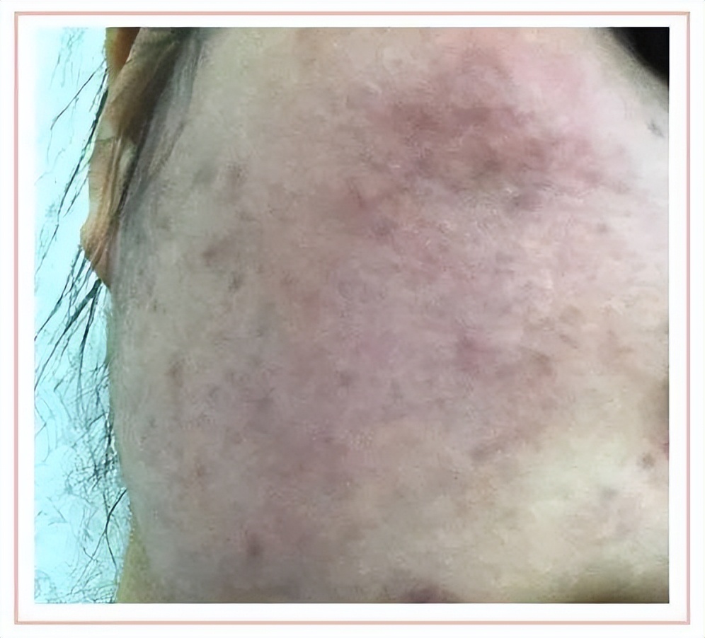 护肤品里的防腐剂都有啥,护肤品里面4种防腐剂