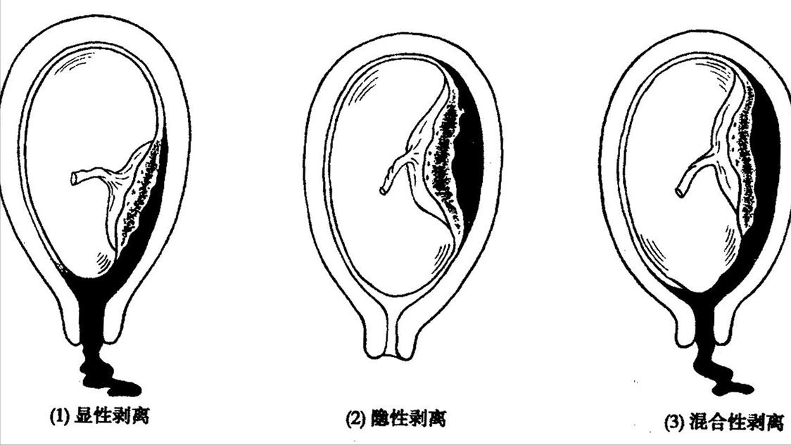 女人如果没有子宫会有什么影响,女性没有子宫和正常人有什么区别