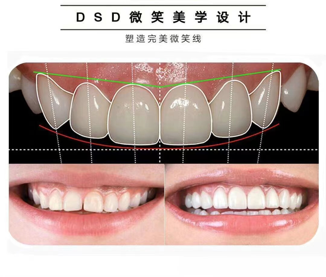 微妮贝尔,美齿专业私人订制