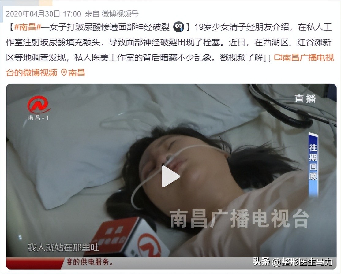 鼻基底玻尿酸栓塞后续治疗方法,鼻基底打玻尿酸栓塞后打溶解酶