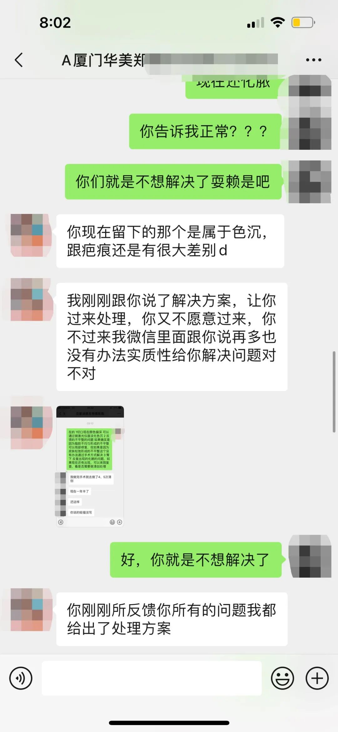 女子去抽脂手术后脸上溃烂,厦门华美整形医院抽脂