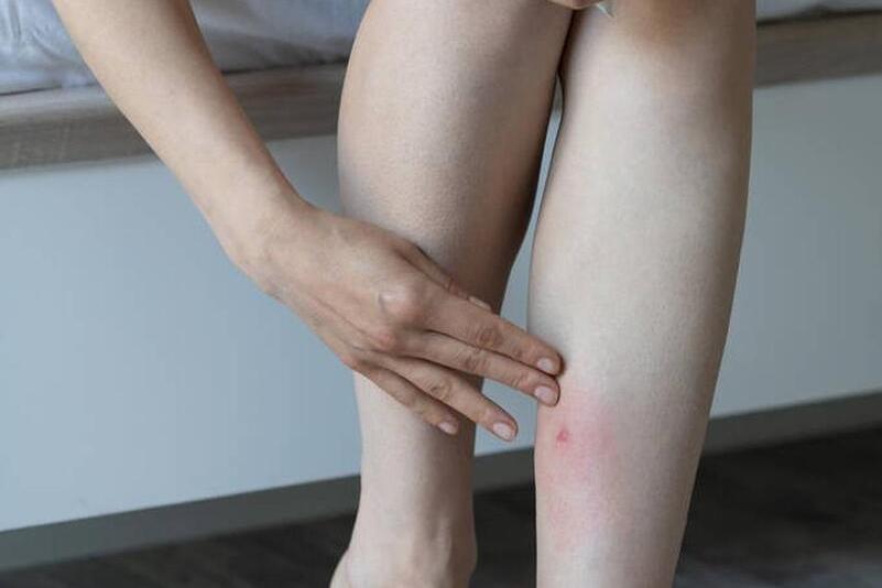 床上小黑虫是什么虫子咬人很痒,床上有虫子咬人怎么消灭最彻底