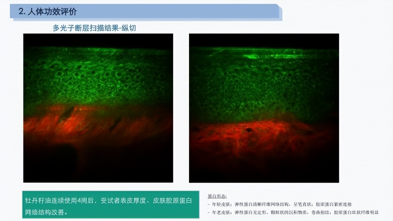 牡丹功效和主治病症,牡丹功效主治和作用