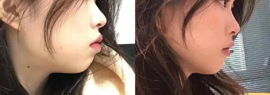 国民初恋毁容了,国民初恋盛世美颜