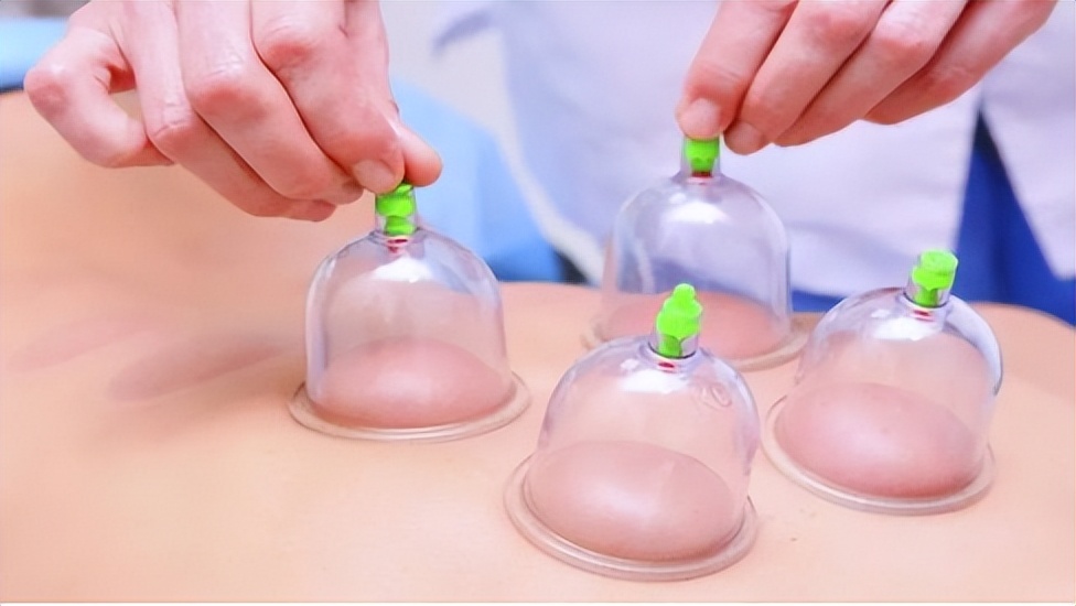 拔火罐益处和弊端,拔火罐有什么好处跟坏处呀