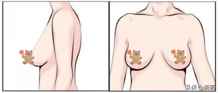 胸部明显大小不一怎么办,胸部越来越小是病理吗