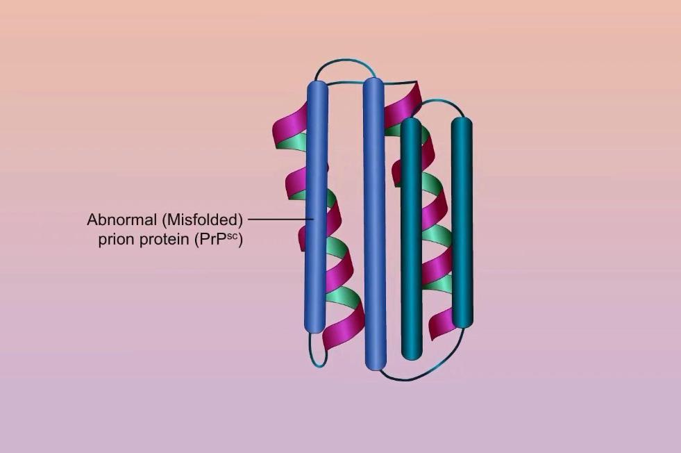 致死率100%！朊病毒烹煮杀不死，无药可救，感染后究竟有多恐怖？
