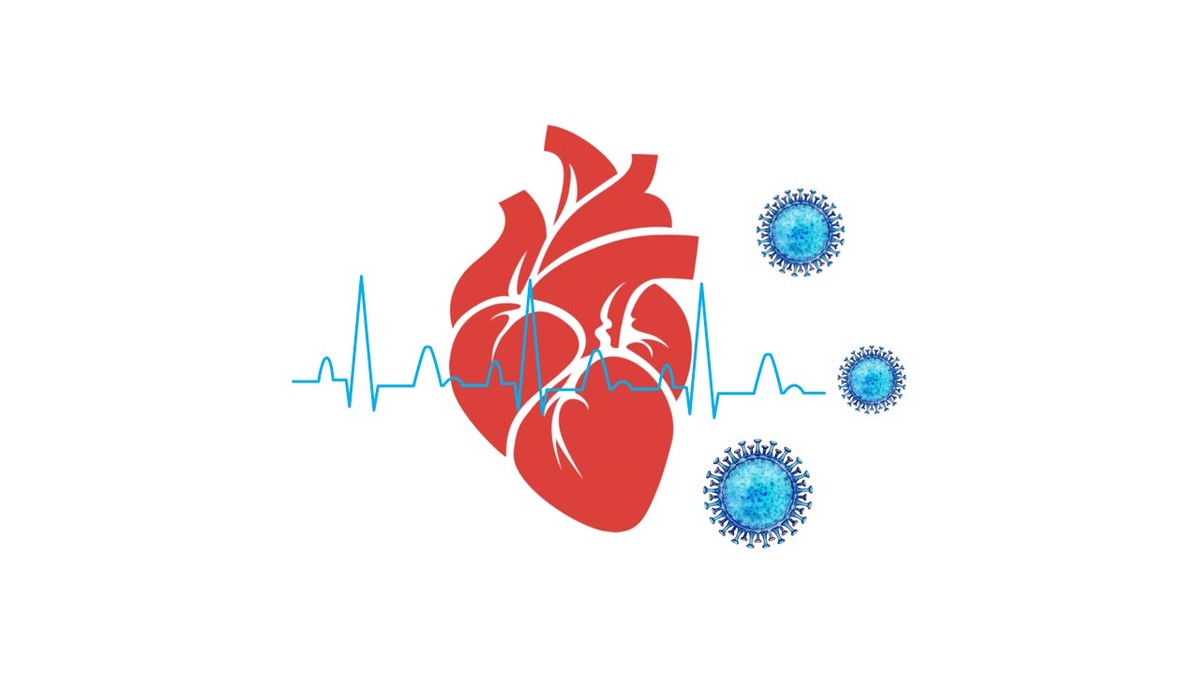 心血管病新冠,心血管疾病新冠