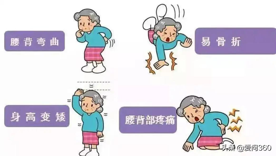 骨骼就像大树，骨质一旦疏松问题就多，让腿脚有力的几个小妙招