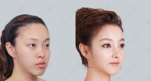 自然美vs人工美,自然美和医美脸