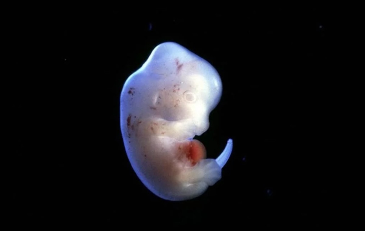 变性手术男转女有什么要求,变性有什么条件