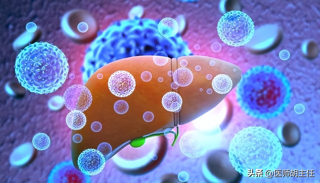 肝病胆红素偏高怎么才能降下来,体检胆红素偏高怎么快速降低