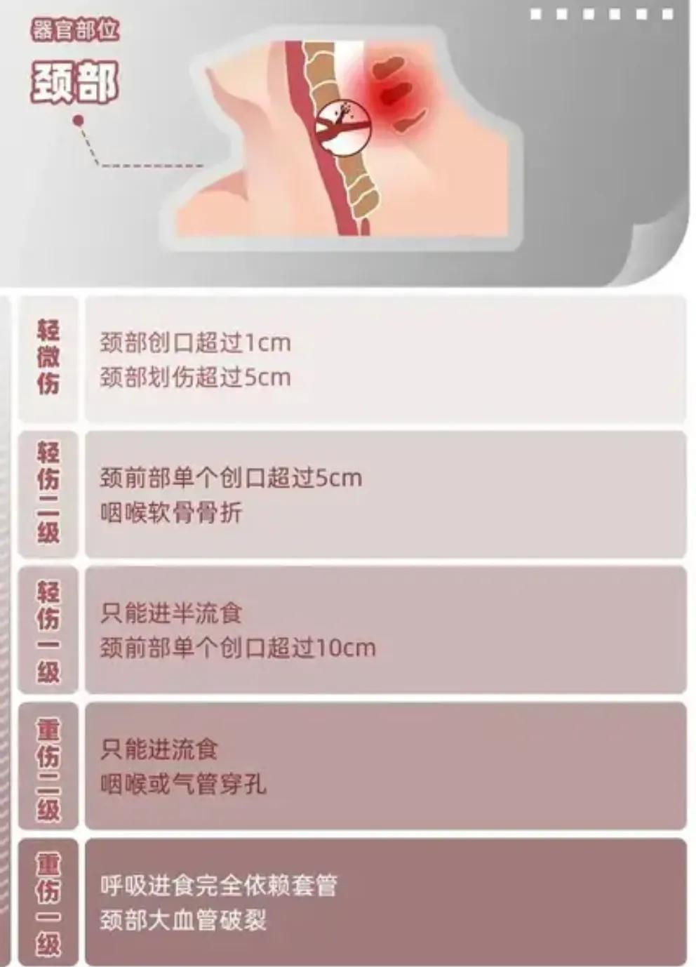 唐山打人轻伤二级鉴定标准,唐山事件轻伤二级