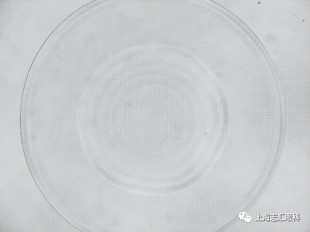 ok镜对所有孩子都有控制效果吗,OK镜和离焦眼镜