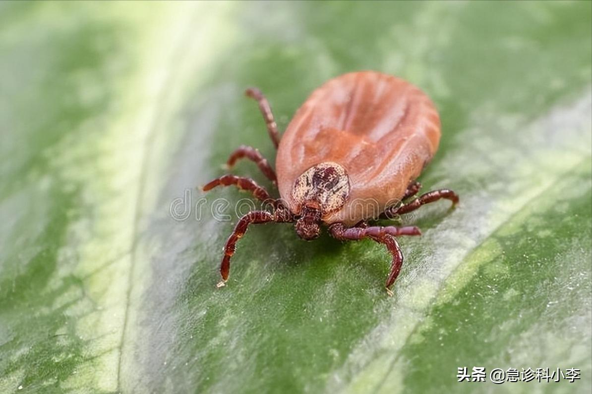 蜱虫咬人死亡率多少,蜱虫咬后死亡率新闻