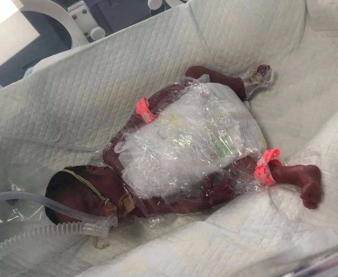 13年孕妇高铁厕所早产，孩子出生后吓坏众人，医生：可能一尸两命