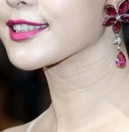 脖子上的纹路叫什么纹,脖子纹路深是什么原因中医