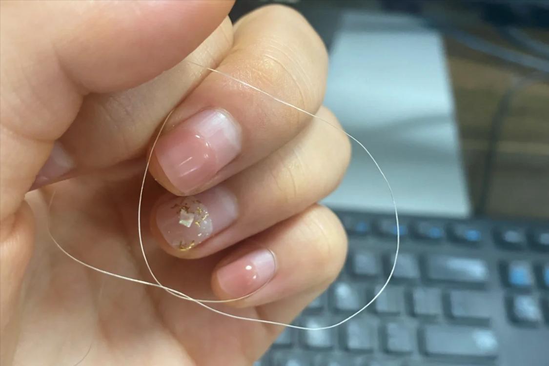 突然发现长了好多白发,年轻长了几根白头发怎么回事