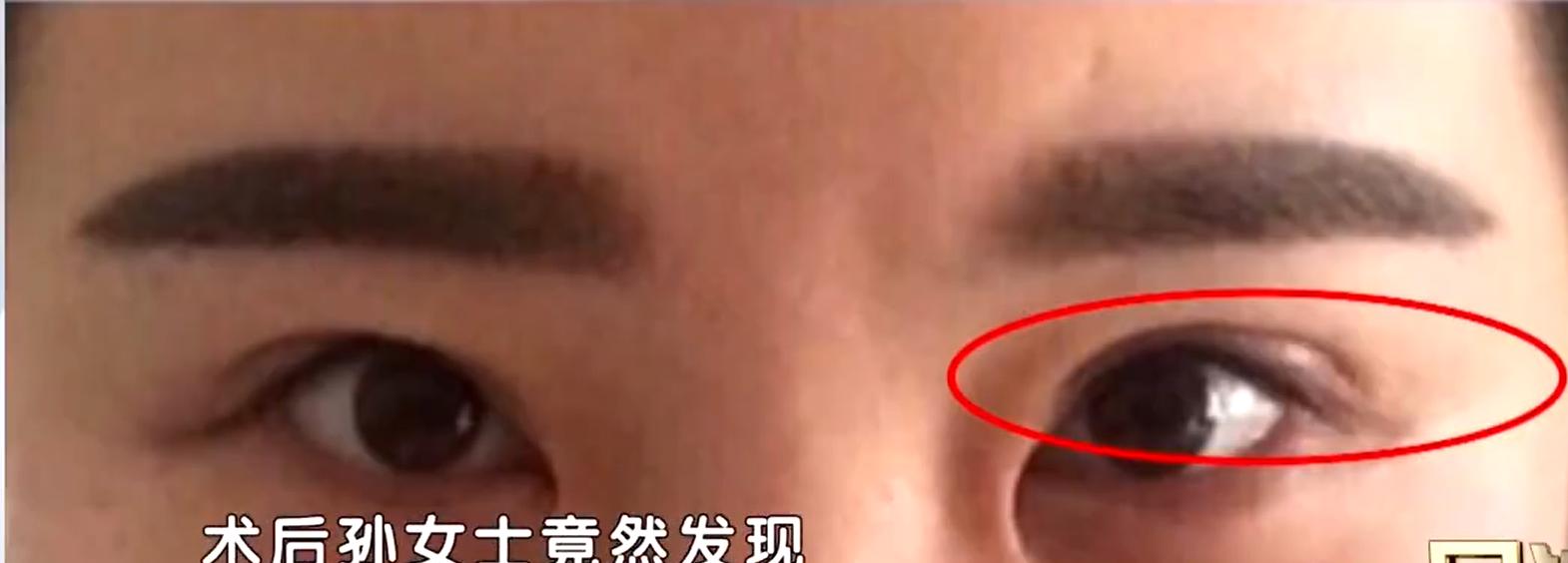 整容医生被换脸成通缉犯电影,整容医生被换脸成通缉犯电视剧