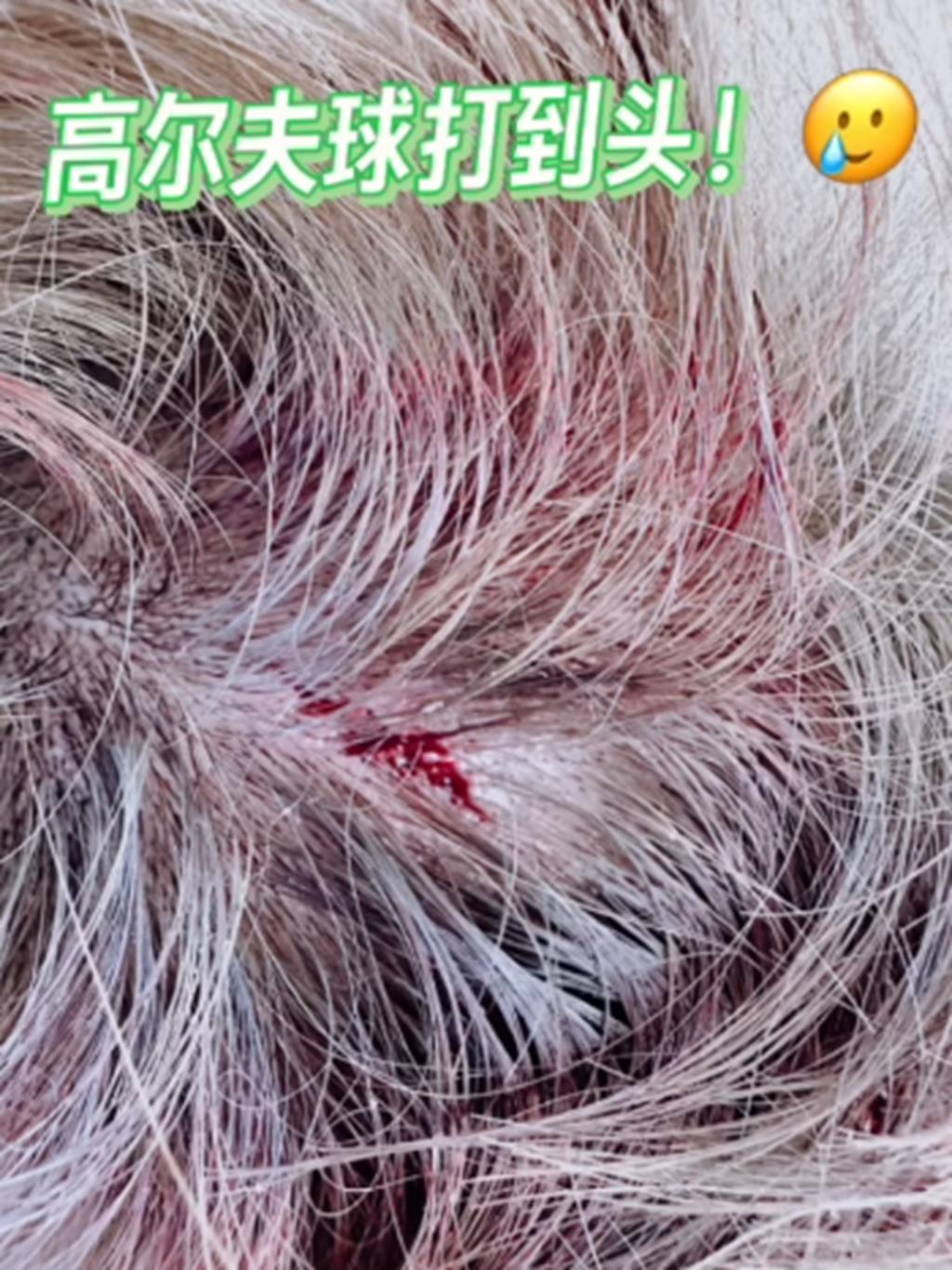 18年前孙耀威事件,孙耀威事件后续