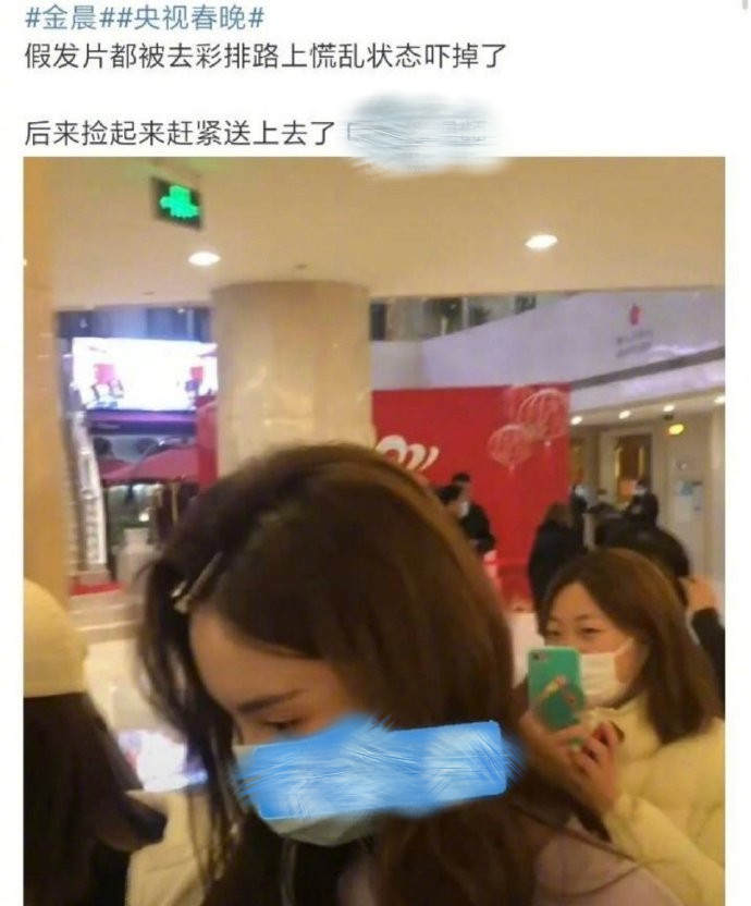 盘点女明星发际线危机,女明星秃头前后对比