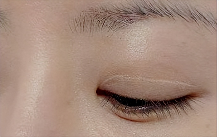 ——拿什么来拯救我的夏日底妆*水光针