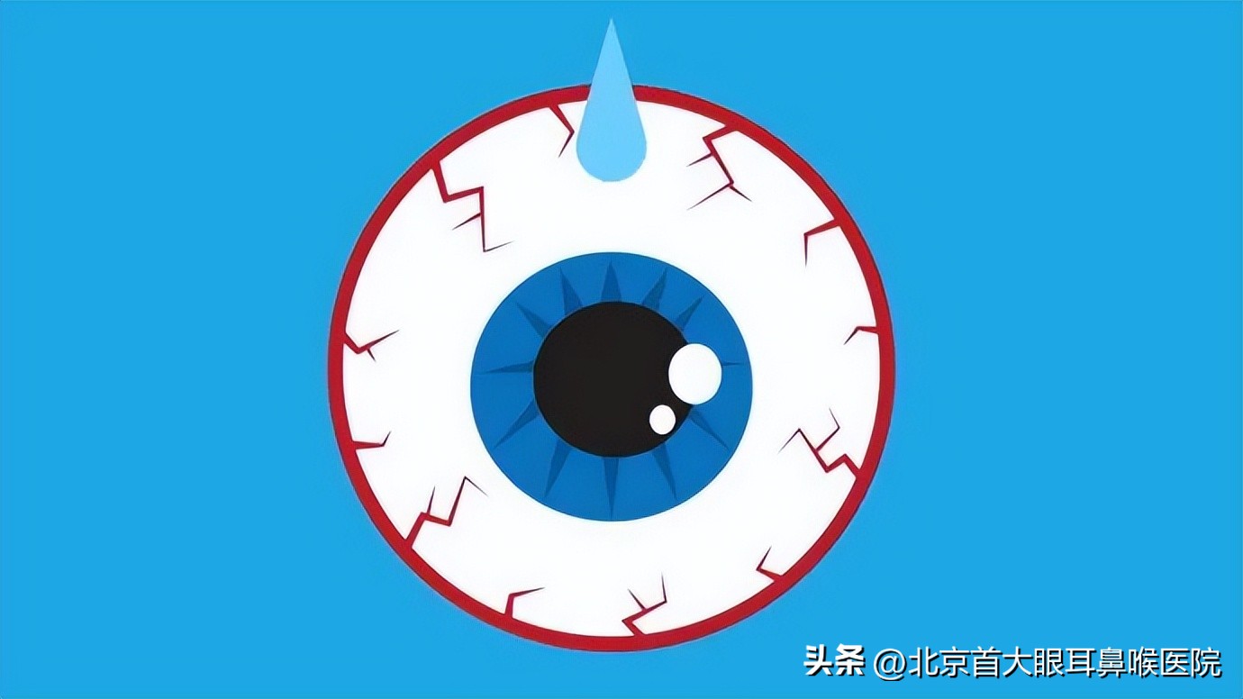 北京干眼症的最佳治疗方法,北京眼科医院治疗黄斑病变