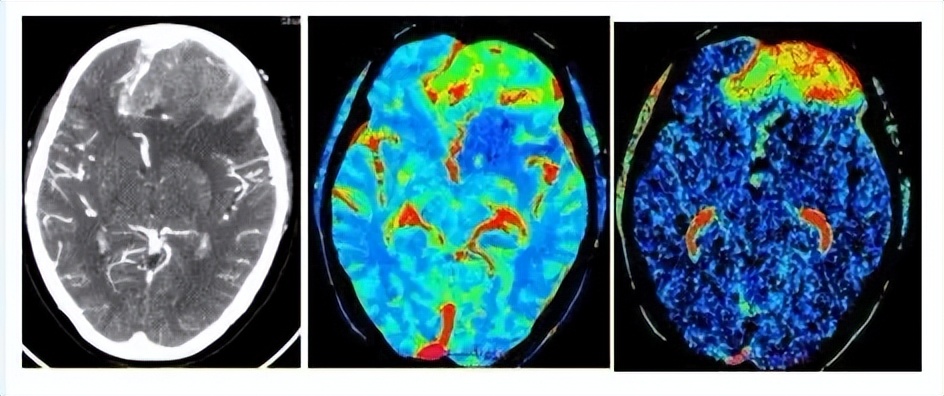 临床医学类专业解读,医学影像学与放射医学的区别