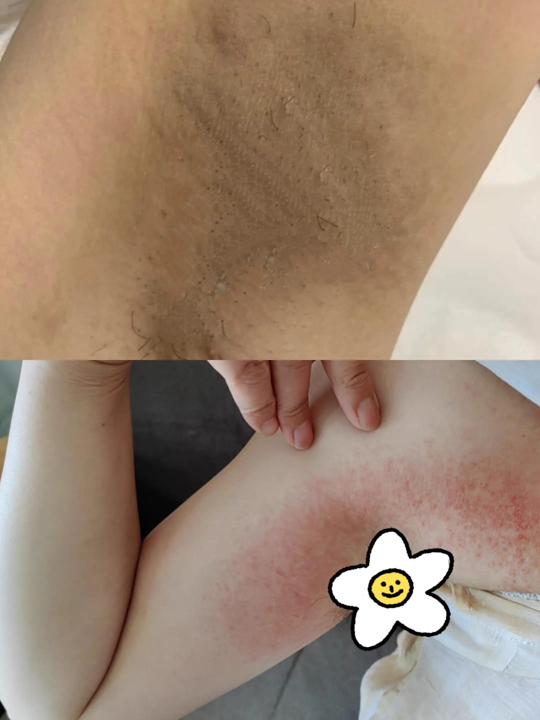 无色无味的止汗露去狐臭测评,汗味大臭怎么选择止汗露