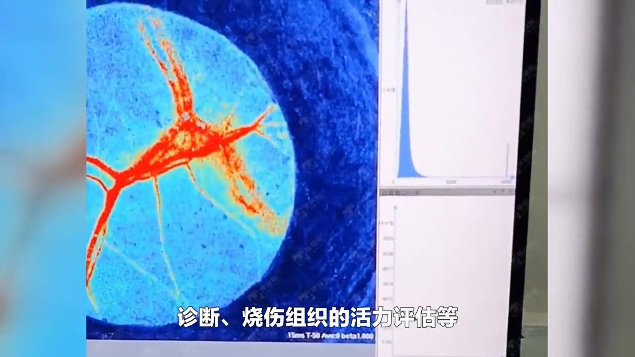 什么是长波和短波辐射,中波红外和长波红外的区别