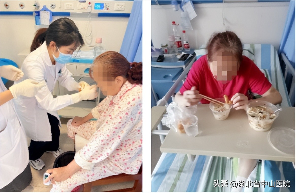 导管球囊扩张术治疗吞咽障碍,导管球囊扩张术治疗吞咽障碍动画