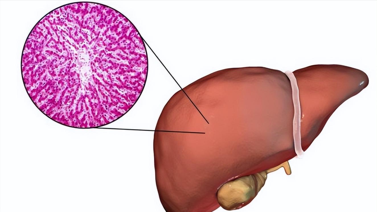 这4种病无需过度治疗,这几种病千万别过度治疗