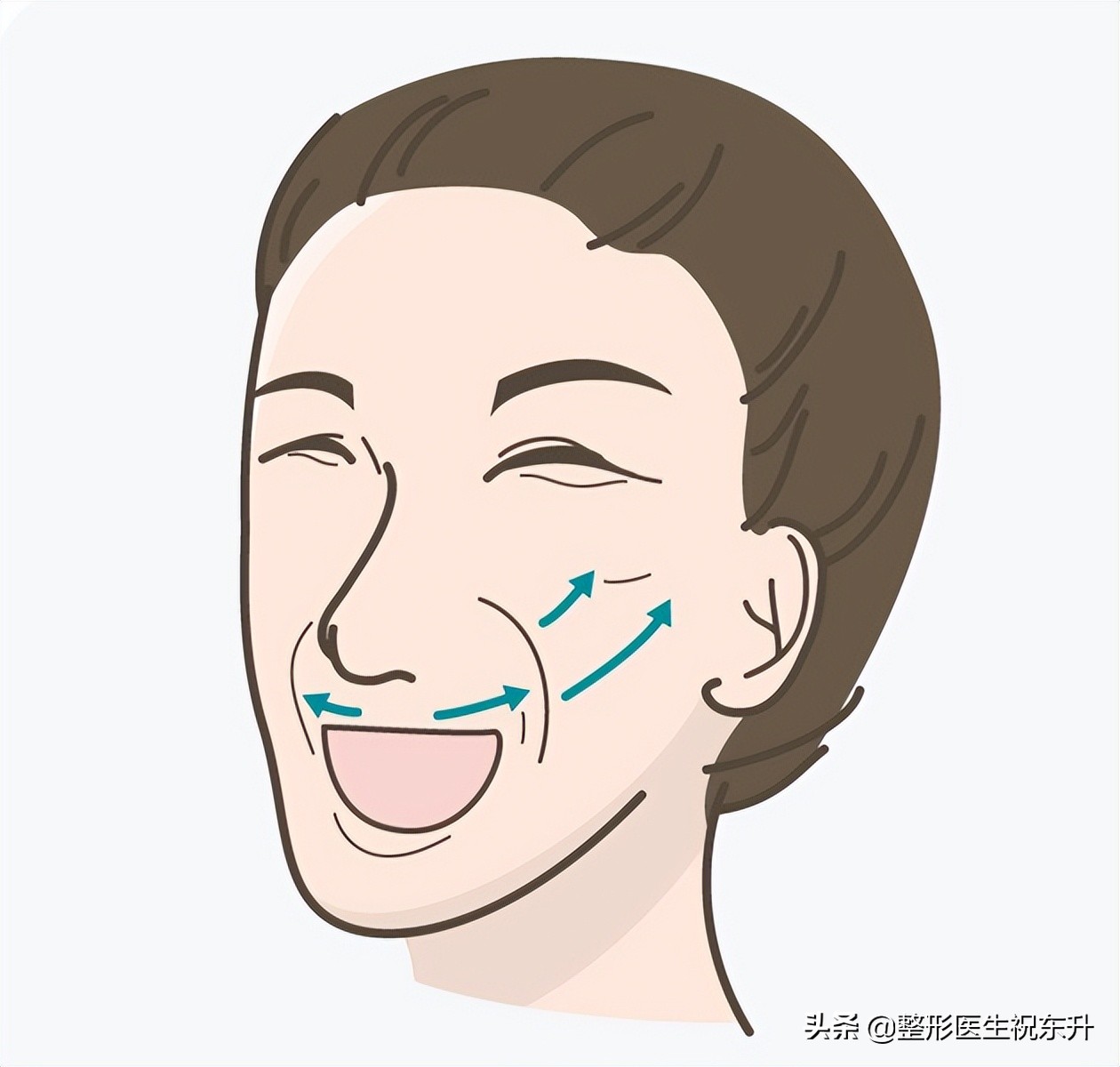 口角纹和法令纹去除方法,法令纹嘴角纹去除最好的方法