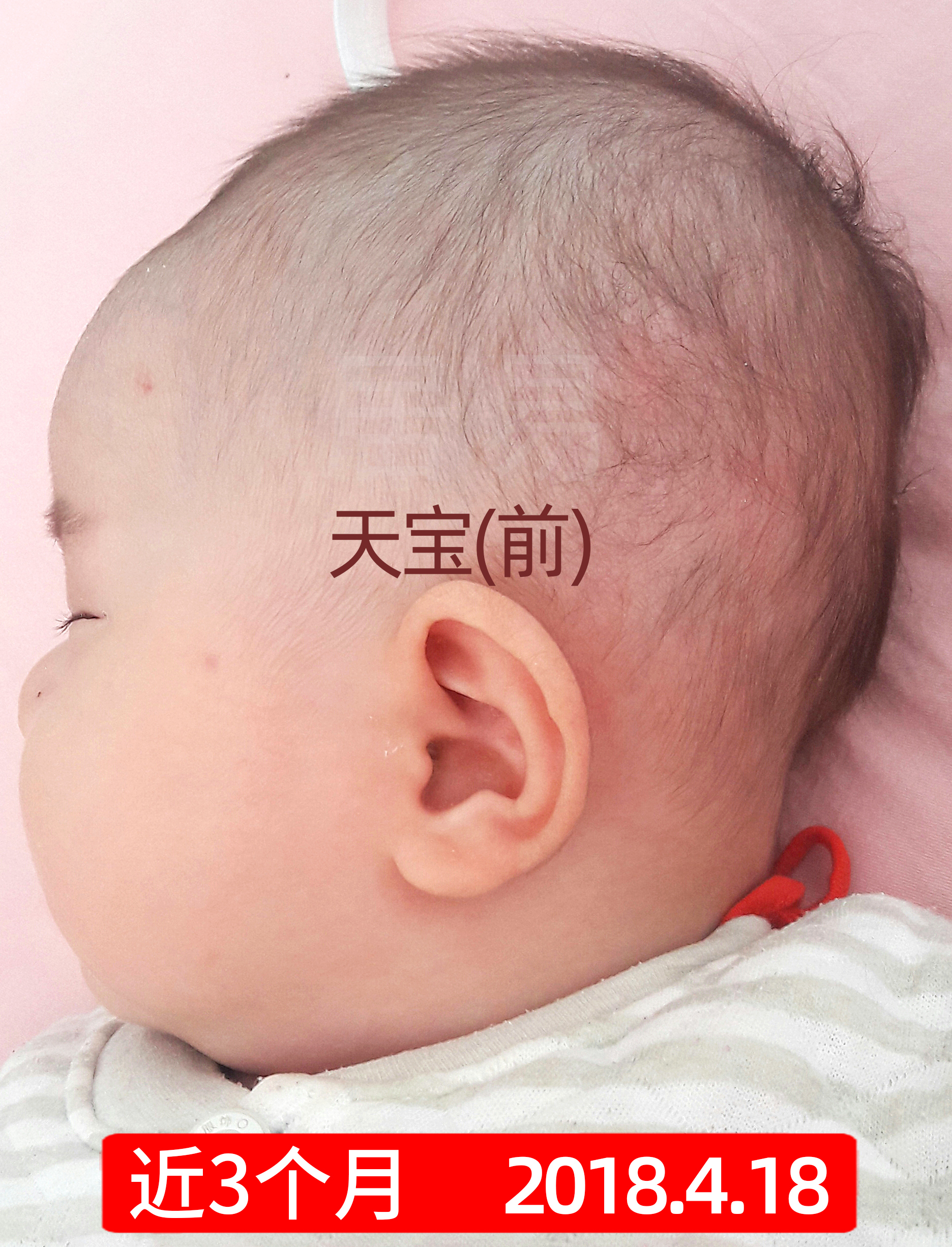 菱形头宝宝头型怎么矫正,上尖下扁头型宝宝头型怎么调整