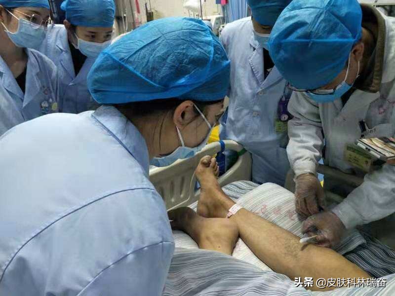 以前没有疤痕会长疤痕疙瘩么,快一年的疤痕疙瘩怎么治疗