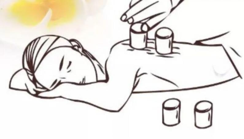 拔火罐吸出来的是湿气还是毒素,拔火罐出来的瘀血是什么样