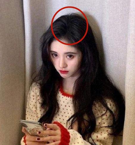 盘点女明星发际线危机,女明星秃头前后对比