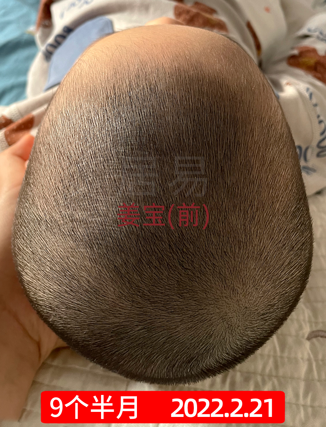 菱形头宝宝头型怎么矫正,上尖下扁头型宝宝头型怎么调整