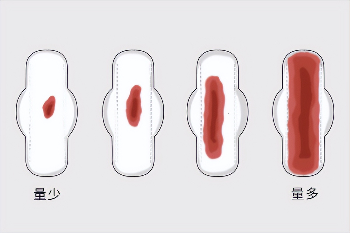 大姨妈一直不走怎么回事吃什么药,大姨妈一直不走的原因