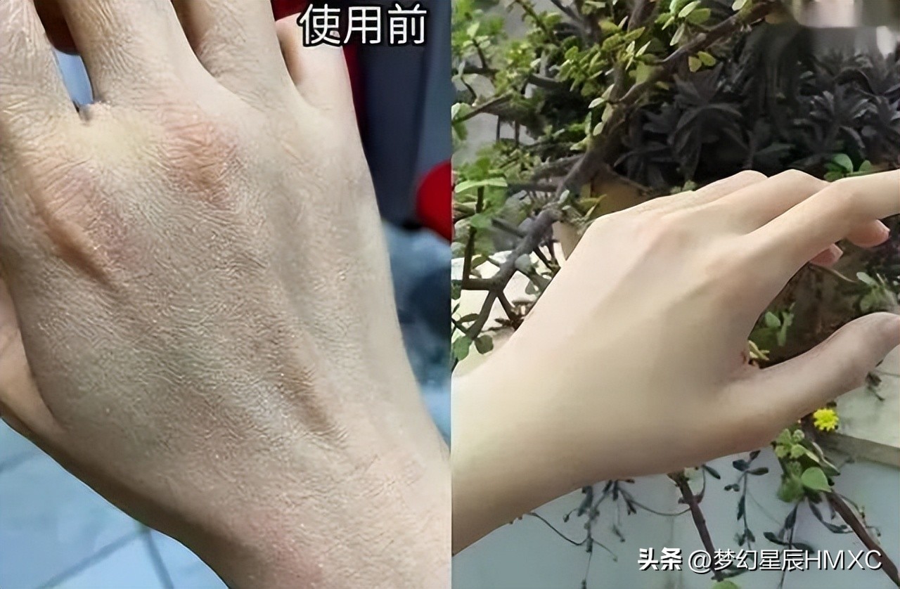 如何让脸白嫩小妙招,如何快速让手脸变得白嫩