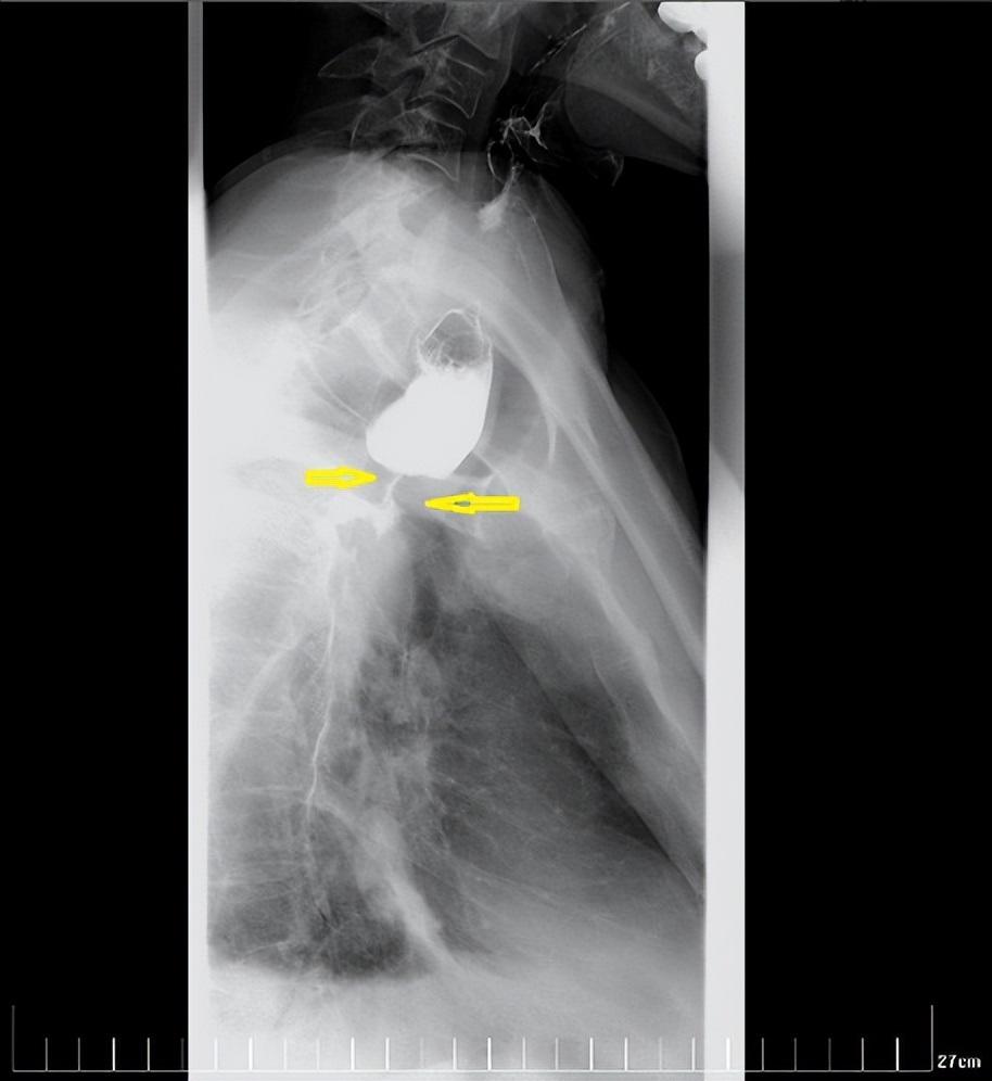 西安国际医学中心磁波刀,西安市国际医学中心肿瘤手术