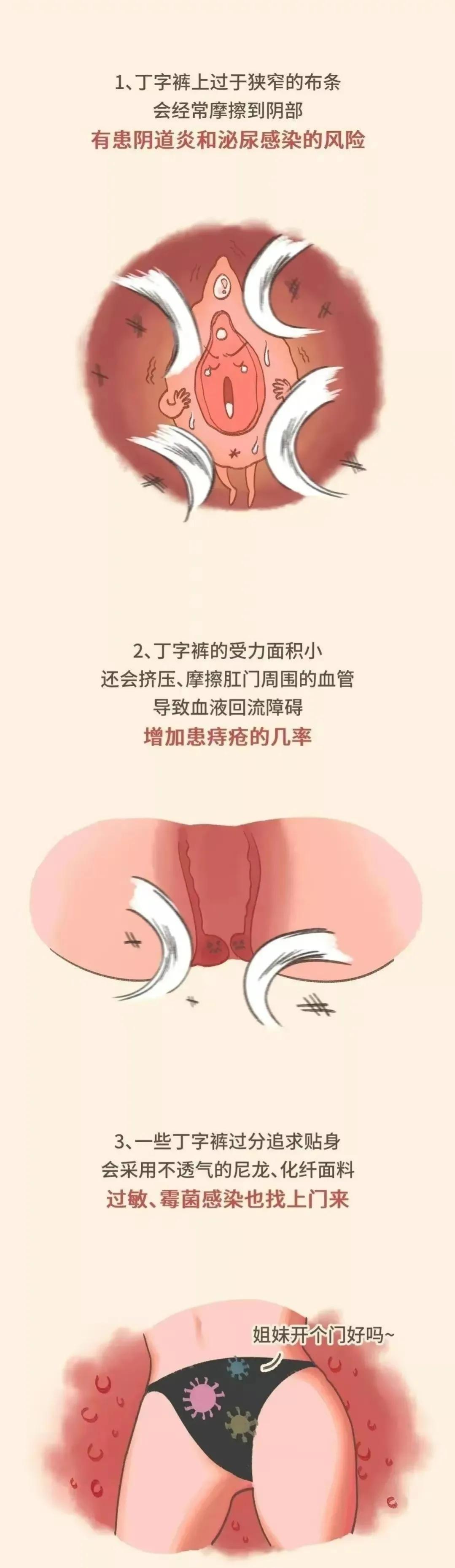 穿丁字裤勒屁股？为什么女生都喜欢穿。（漫画揭秘）